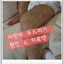 14개월 아기 만성두드러기 증상 원인 & 치유기간