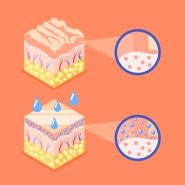 요철 관리 꿀팁: 각질 제거와 수분 공급이 핵심!