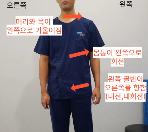 체형불균형의 흔한 특징(Left AIC pattern) : 네이버 블로그