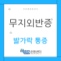 대구 재활전문: 발가락이 휘고 아픈 무지외반증 증상 및 운동 방법 알려드려요!