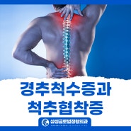 대구정형외과추천 경추척수증과 척추협착증의 차이점 및 허리치료법