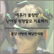 원형탈모, 시간이 지나면 머리카락이 자랄까 ; 분당탈모 서현역원형탈모 수내동스트레스성탈모