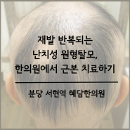 분당원형탈모 재발 반복 ; 원형탈모한의원 분당탈모 서현역탈모약침 수내동스트레스성탈모 판교2030탈모 정자동전두탈모