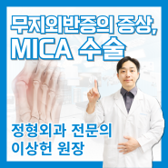 무지외반증의 증상과 MICA수술에 대해🦶 [역촌동 정형외과 리드힐병원]