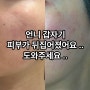 "언니 피부가 뒤집어졌어요ㅠㅠ" 환절기 날씨 변화에 따른 뒤집어진 내 피부, 진수재미 루틴법 꿀팁 대방출