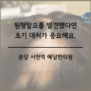 원형탈모 초기 대처의 중요성 ; 분당원형탈모 서현역청소년탈모 수내동급성휴지기탈모 판교 스트레스성탈모