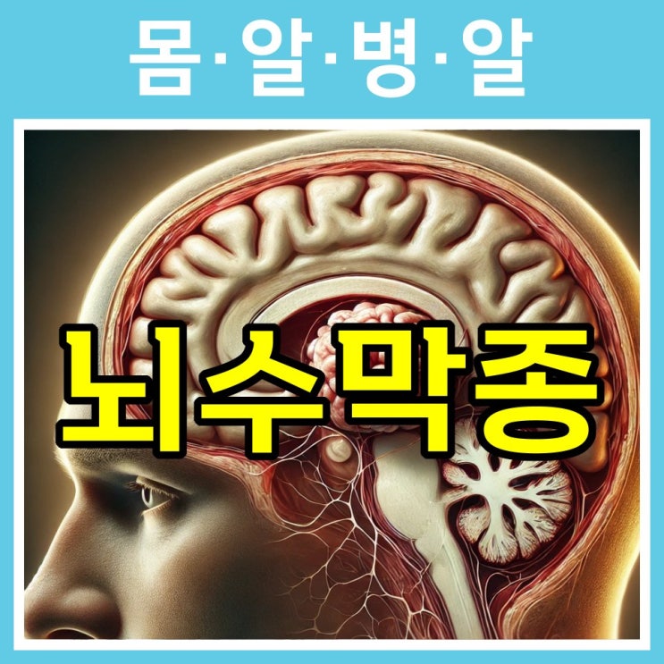 뇌수막종, 증상 두통 간질발작 시력변화 운동이상 언어 인지장애, 원인 유전자 방사선, 수술로 치료하세요. : 네이버 블로그