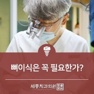 뼈이식은 꼭 필요한가? 서면치과잘하는곳 세종치과에서 알려드립니다.