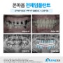 구서동임플란트 전체임플란트가 필요할 때