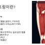 햄스트링 파열 증상 병원 허벅지 통증 발생했을 때 방법