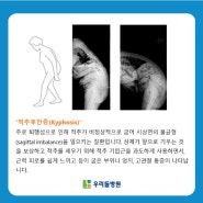 척추관 협착증까지 동반된 후만증