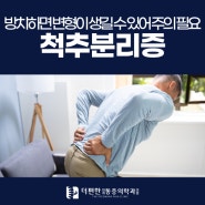 구로 척추분리증, 방치하면 변형이 생길 수도 있어 주의가 필요해