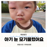 아기 눈에 모기물렸을 때 붓기빠지는데 걸리는 시간(두드리진시럽)