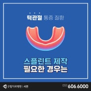 부산턱관절병원 스플린트 제작이 필요한 경우