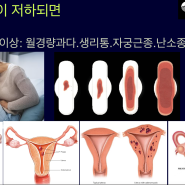 생리양이 많으면 제발 빨리 치료받으세요. 대전 생리통 한의원