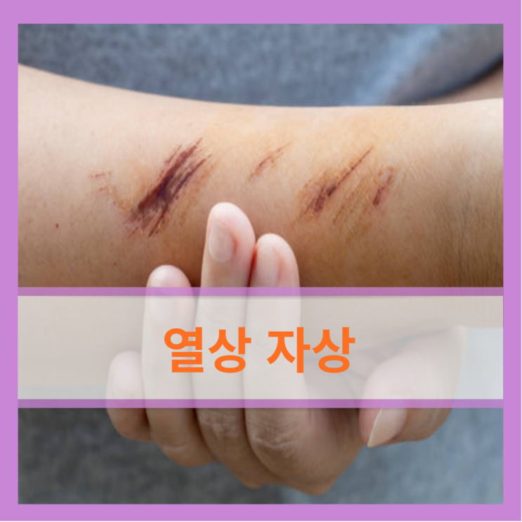 피부의 상처 열상과 자상 차이 치료 : 네이버 블로그