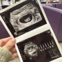 2. 임신극초기 (4주~10주차) 일상 ㅣ 임밍아웃하기 ㅣ 임신 선물