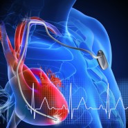 부정맥의 원인: 심방세동과 5가지 주요 요인, 증상과 치료