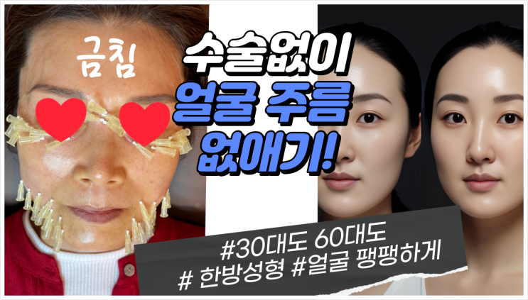 피부과에 보톡스가 있다면 한의원에는 금침이 있다 : 네이버 블로그