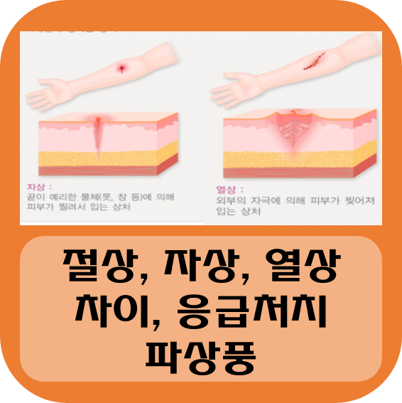 [상처 구분법] 절상, 열상, 자상 차이 대처법 응급처치 봉합술 파상풍 : 네이버 블로그