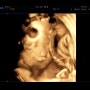 [임신 29주, 30주] 임신후기 입체초음파로 얼굴 보기 / 30주 배크기 / 평택 라움산부인과