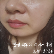 잠실 피부과 홍조 레이저 인모드 리프팅 후기