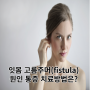 영등포구청치과 잇몸 고름주머니(fistula) 원인 ·통증 ·치료 방법은?