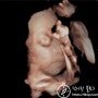 [임신, 출산 기록] 임신 27주~31주차(코로나)
