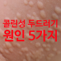 콜린성 두드러기 원인 5가지, 올바른 예방법은?