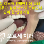 강남 턱관절 찾아오시는 치과의 다양한 치료 경우들