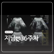 지닝ღ36-37주,마지막검진,제왕절개
