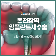 온천장역 임플란트재수술 해야 하는 상황이라면?