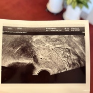 마리아병원 임신확인서, 임신 4주 +5일 차(24.01.15)아기집확인