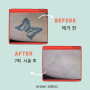 문신제거 대한민국 1인자 이레이저타투 eraser.tattoo