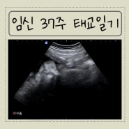 임신 37주 태교일기 / 정기검진