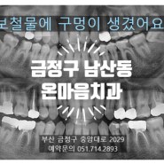 금정구 양산 치과 / 보철물에 구멍, 보철물 파절이 되었어요