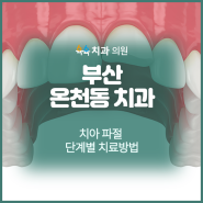 부산 온천동 치과 치아 파절 단계별 치료방법