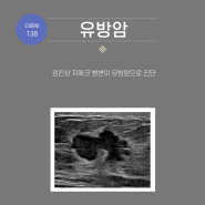 [부산 유방 외과 전문의 박근준유외과의원] 138.검진에서 발견된 유방암