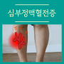 심부정맥혈전증 증상으로 병원에서 검사받은 후기 알아봐요