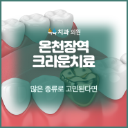 온천장역 크라운치료 많은 종류로 고민된다면