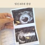 임신 8주차 증상 ( 젤리곰 초음파/ 심장 소리/ 태아 발달/ 입덧/ 배크기 )