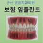 군산 미장동 치과 - 만65세 이상 건강보험 임플란트