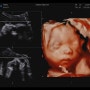 [임신기록] 25~28주, 공포의 임당재재검 입체초음파 임산부 일상