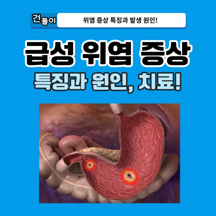 급성 위염 증상 6가지 특징 위염 치료 방법 : 네이버 블로그