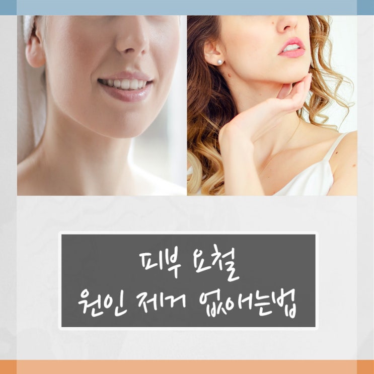 피부 요철 원인 및 제거 없애는법 : 네이버 블로그
