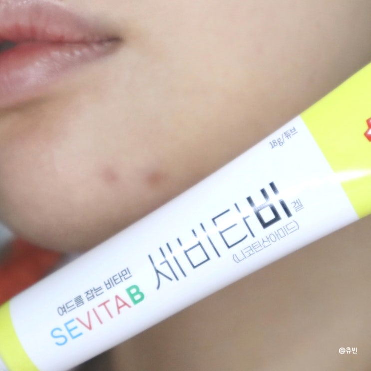 약국 여드름연고 세비타비겔 가격 사용법 부작용 내돈내산 후기 : 네이버 블로그