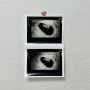 둘째 임신 7주 ~ 9주 입덧파티 , 임신초기검사