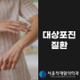 대상포진은 어떤 질환일까? 원인과 치료 방법까지!