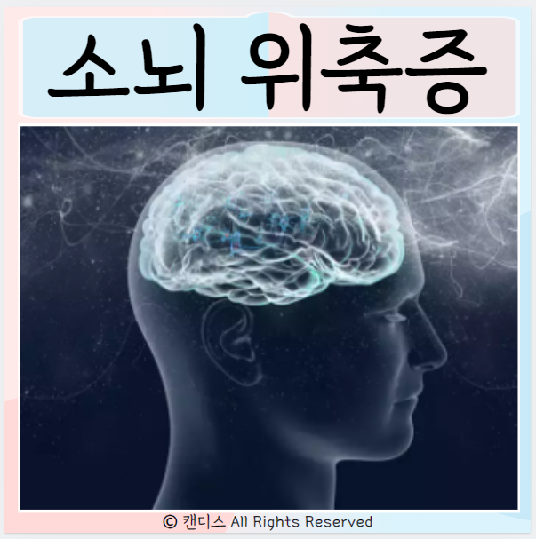 소뇌 위축증 원인 발병시기 증상 치료 : 네이버 블로그