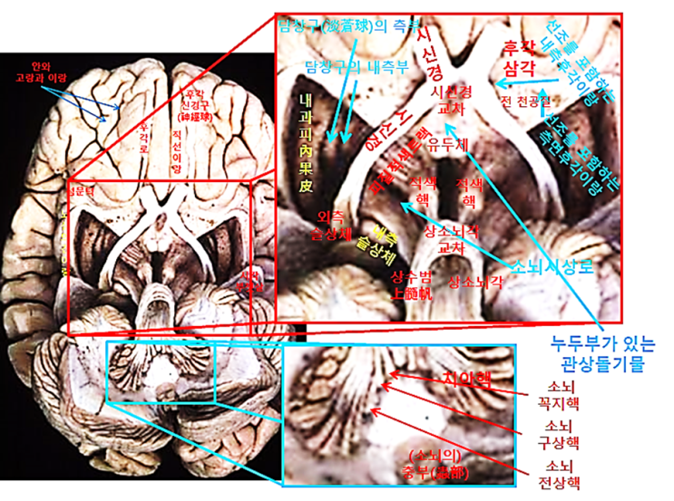 대뇌_23: 소뇌, 중뇌, 간뇌, 종뇌의 내부 특징- 해부된 뇌의 복측면 : 네이버 블로그